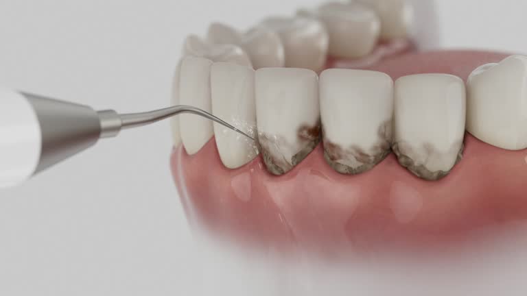 Trusted Emergency Dentist service in Key Biscayne, FL - Dentist Open Now